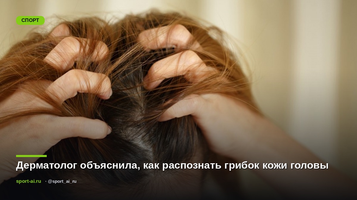 Дерматолог объяснила, как распознать грибок кожи головы