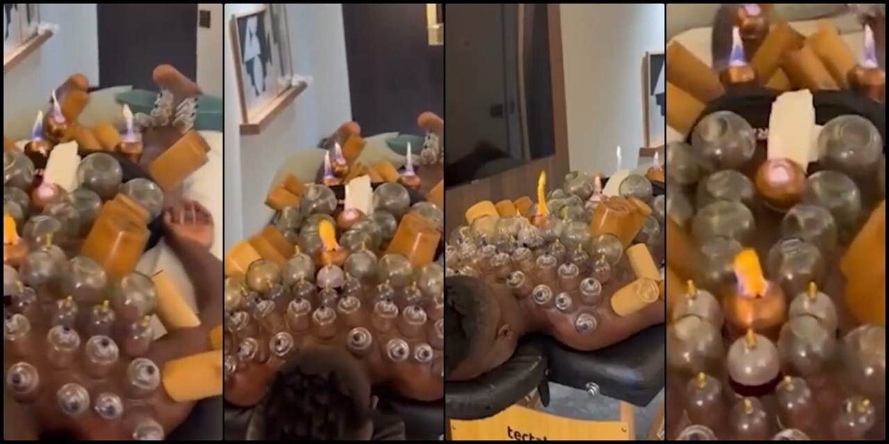 Андре Онана показал видео с баночным массажем